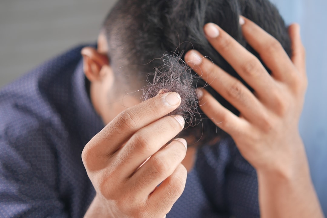 Why Is My Hair Falling Out? A Complete Guide to Hair Loss Causes and Solutions